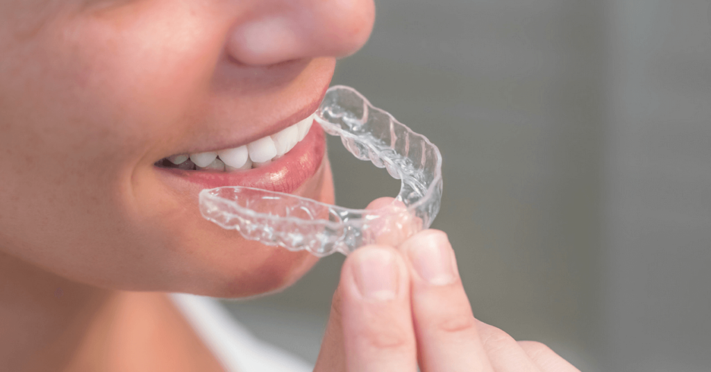 Invisalign By Mirror Lake Dental in Camrose Alberta